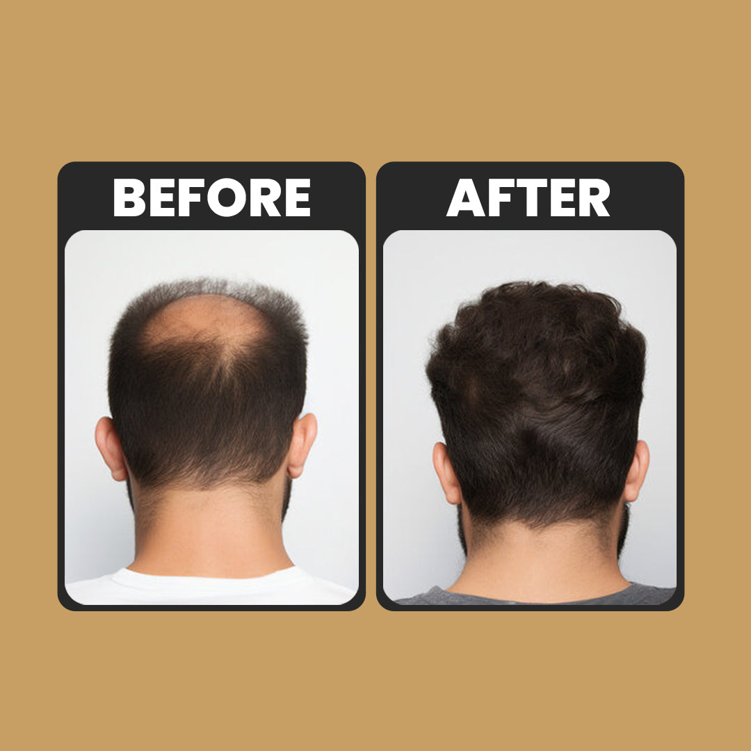 Root Activator Conditioner